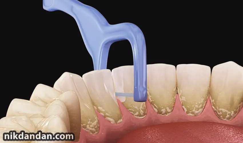 Mouth-body connection in dental health